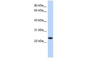 NKAIN4 antibody used at 1 ug/ml to detect target protein.