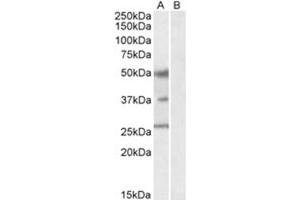 Image no. 1 for anti-Forkhead Box A1 (FOXA1) (C-Term) antibody (ABIN374334) (FOXA1 antibody  (C-Term))