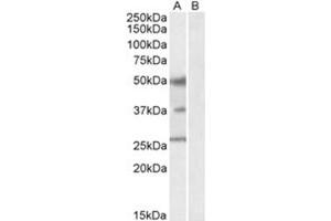 Image no. 1 for anti-Forkhead Box A1 (FOXA1) (C-Term) antibody (ABIN374334)