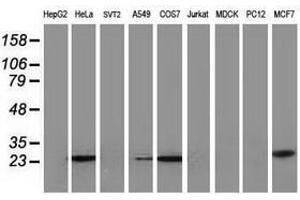 Image no. 4 for anti-Adenylate Kinase 4 (AK4) antibody (ABIN1496530) (AK4 antibody)