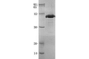 Validation with Western Blot (SPARC Protein (His tag))
