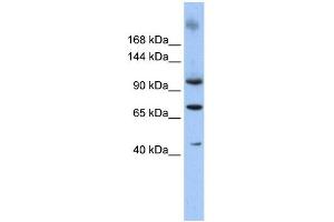 WB Suggested Anti-TUT1 Antibody Titration: 0. (TUT1 antibody  (N-Term))