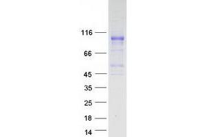 Western Blotting (WB) image for Fibroblast Growth Factor Receptor 1 (FGFR1) (Transcript Variant 4) protein (Myc-DYKDDDDK Tag) (ABIN2721113)