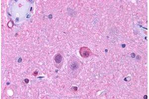 Anti-NPY5R antibody  ABIN1049127 IHC staining of human brain, neurons and glia. (NPY5R antibody  (Cytoplasmic Domain))