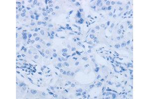Immunohistochemistry (IHC) image for anti-Matrix Metallopeptidase 25 (MMP25) antibody (ABIN1873725)