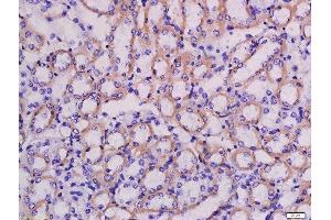 Formalin-fixed and paraffin embedded mouse kidney labeled with Anti-LRRC67 Polyclonal Antibody, Unconjugated  at 1:200 followed by conjugation to the secondary antibody and DAB staining. (PPP1R42 antibody  (AA 201-300))