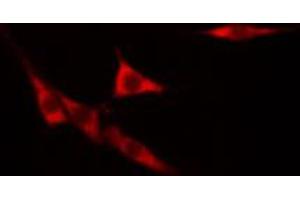 ABIN6268773 staining hacat cells by IF/ICC. (KRT14 antibody  (N-Term))