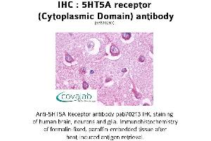 Image no. 1 for anti-Serotonin Receptor 5A (HTR5A) (3rd Cytoplasmic Domain) antibody (ABIN1731379) (Serotonin Receptor 5A antibody  (3rd Cytoplasmic Domain))