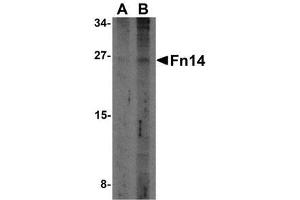 Western blot analysis of Fn14 in HepG2 cells with AP30344PU-N Fn14 antibody at (A) 2 and (B) 4 μg/ml. (TNFRSF12A antibody)