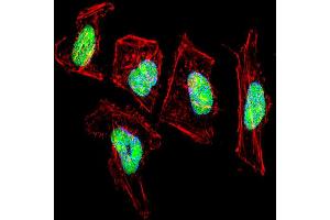 Fluorescent confocal image of Hela cell stained with NFIC Antibody . (NFIC antibody  (AA 180-208))