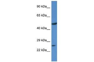 Western Blotting (WB) image for anti-Kruppel-Like Factor 17 (KLF17) (N-Term) antibody (ABIN405290) (KLF17 antibody  (N-Term))