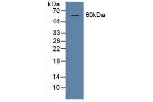 Figure. (BMP6 antibody  (AA 375-502))