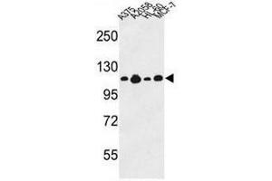 Western blot analysis of COL17A1 Antibody (Center) in A375, A2058, HL-60, MCF-7 cell line lysates (35µg/lane). (COL17A1 antibody  (Chain alpha 1, Middle Region))