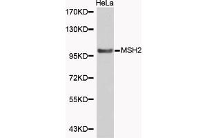Western blot analysis of extracts of HeLa cells, using MSH2 antibody (ABIN5969993). (MSH2 antibody)