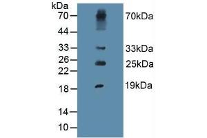 Figure. (PIIINP antibody  (AA 24-153))