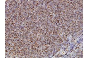 Immunoperoxidase of monoclonal antibody to ADD1 on formalin-fixed paraffin-embedded human tonsil. (alpha Adducin antibody  (AA 1-662))