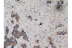 IHC-P analysis of Human Breast Tissue, with DAB staining.
