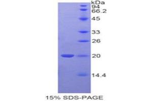 SDS-PAGE (SDS) image for Tafazzin (TAZ) (AA 154-292) protein (His tag) (ABIN2126913)
