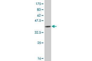 Western Blot detection against Immunogen (35. (NFKBIB antibody  (AA 56-145))