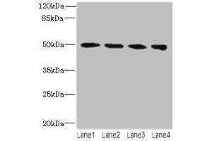 Western blot All lanes: TUBB2A antibody at 14 μg/mL Lane 1: MCF-7 whole cell lysate Lane 2: Hela whole cell lysate Lane 3: HepG2 whole cell lysate Lane 4: MDA-MB-231 whole cell lysate Secondary Goat polyclonal to rabbit IgG at 1/10000 dilution Predicted band size: 50 kDa Observed band size: 50 kDa (TUBB2A antibody  (AA 1-445))