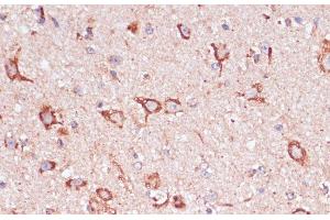 Immunohistochemistry of paraffin-embedded Mouse spinal cord using ENTPD6 Polyclonal Antibody at dilution of 1:100 (40x lens). (ENTPD6 antibody)
