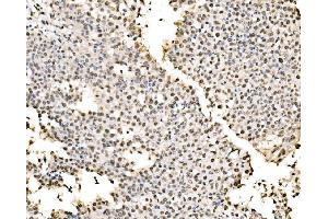 IHC analysis of SSB using anti-SSB antibody (ABIN7602125).