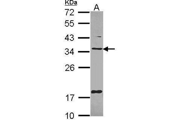 TMX1 anticorps  (C-Term)