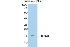 Western Blotting (WB) image for anti-Single Immunoglobulin and Toll-Interleukin 1 Receptor (TIR) Domain (SIGIRR) (AA 1-118) antibody (ABIN1171738) (SIGIRR antibody  (AA 1-118))