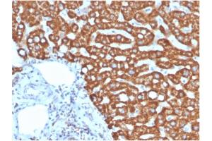 Formalin-fixed, paraffin-embedded human liver in colon stained with Heat Shock Protein 60 Mouse Monoclonal Antibody (HSPD1/875). (HSPD1 antibody)