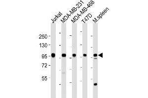 Western Blotting (WB) image for anti-Enhancer of Zeste Homolog 2 (EZH2) (AA 1-296), (N-Term) antibody (ABIN650707)