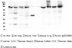 Western blot analysis of CRM1 using anti-CRM1 antibody . (XPO1 antibody  (AA 966-1071))