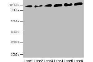 Western blot All lanes: PCDH1 antibody at 2. (Protocadherin 1 antibody  (AA 60-220))