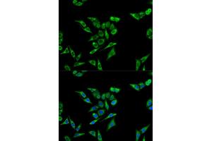 Immunofluorescence analysis of A549 cells using ACAT1 antibody (ABIN5973073). (ACAT1 antibody)