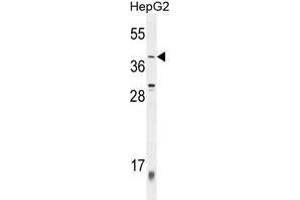 ZNF763 Antibody (C-term) western blot analysis in HepG2 cell line lysates (35 µg/lane). (ZNF763 antibody  (C-Term))