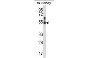 Western blot analysis in mouse kidney tissue lysates (35ug/lane). (STK32B antibody  (C-Term))