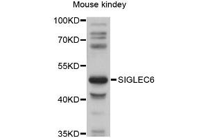 Western blot analysis of extracts of mouse kidney, using SIGLEC6 antibody (ABIN6292272) at 1:1000 dilution. (SIGLEC6 antibody)