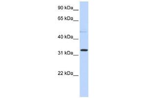 NEU4 antibody used at 1 ug/ml to detect target protein. (Sialidase 4 antibody  (N-Term))