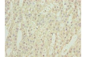 Immunohistochemistry of paraffin-embedded human adrenal gland tissue using ABIN7153761 at dilution of 1:100 (GEMIN6 antibody  (AA 1-167))