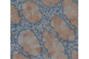 IHC-P analysis of Human Tissue, with DAB staining. (RETNLB antibody  (AA 24-111))