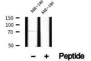 Western blot analysis of extracts of ME-180 cells, using Phospho-p63 (Ser160/162) Antibody.