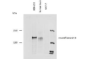 Western blotting analysis of human neurofilament H protein using mouse monoclonal antibody NF-01 on lysates of HEK-293 cell line, human brain lysate, and MCF-7 cell line (neurofilament non-expressing cell line, negative control) under reducing conditions. (NEFH antibody)