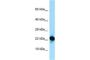 Host: Rabbit Target Name: RPL18A Sample Type: Jurkat Whole Cell lysates Antibody Dilution: 1. (RPL18A antibody  (C-Term))