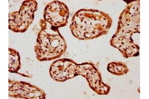 Immunohistochemistry (IHC) image for anti-Bone Morphogenetic Protein Receptor 1A (BMPR1A) (AA 177-532) antibody (ABIN7145704)
