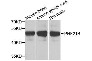Western blot analysis of extracts of various cell lines, using PHF21B antibody. (PHF21B antibody  (AA 322-531))
