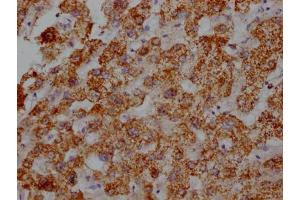 IHC image of ABIN7127355 diluted at 1:100 and staining in paraffin-embedded human liver tissue performed on a Leica BondTM system. (Recombinant ATP5B antibody)