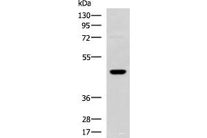 Western blot analysis of TM4 cell lysate using DNAJA4 Polyclonal Antibody at dilution of 1:800 (DNAJA4 antibody)