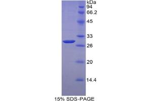 SDS-PAGE analysis of Mouse MYH4 Protein. (MYH4 Protein)