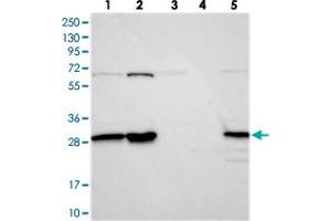 Western blot analysis of Lane 1: RT-4, Lane 2: U-251 MG, Lane 3: Human Plasma, Lane 4: Liver, Lane 5: Tonsil with INO80E polyclonal antibody  at 1:250-1:500 dilution. (INO80E antibody)