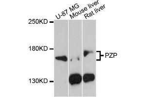 Western blot analysis of extracts of various cell lines, using PZP antibody (ABIN5971715) at 1:3000 dilution. (PZP antibody)