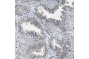 Immunohistochemical staining of human prostate with ZNF516 polyclonal antibody  shows granular cytoplasmic positivity in glandular cells.